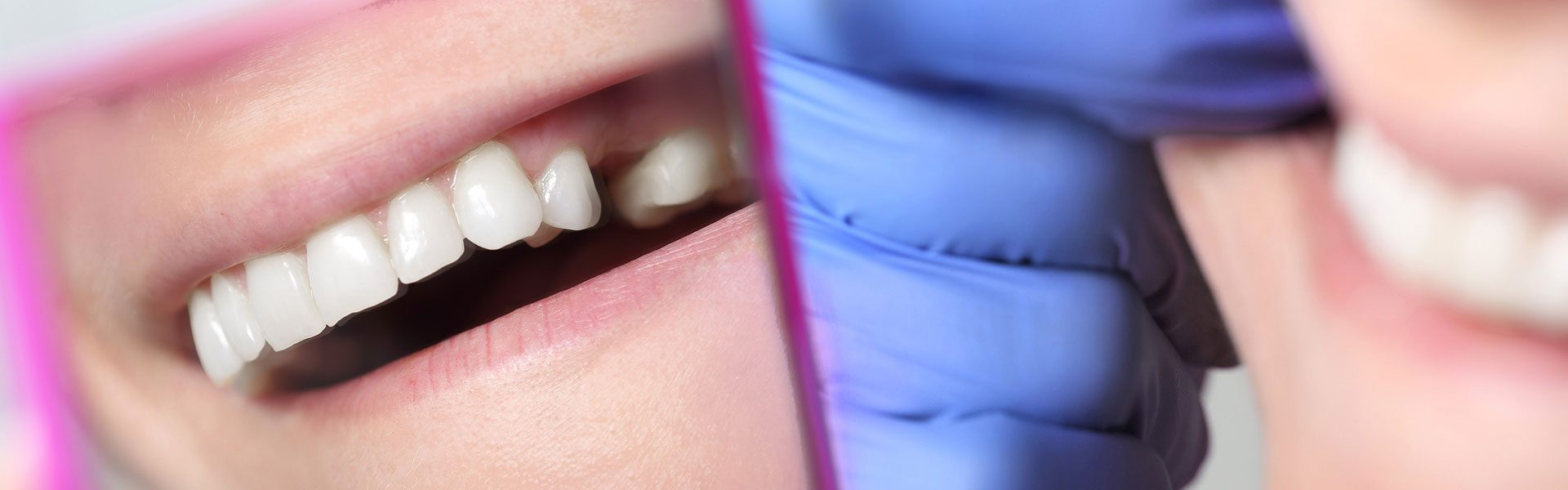 A Missing Tooth Makes it Hard to Smile. Restore Your Smile with a Dental Bridge!